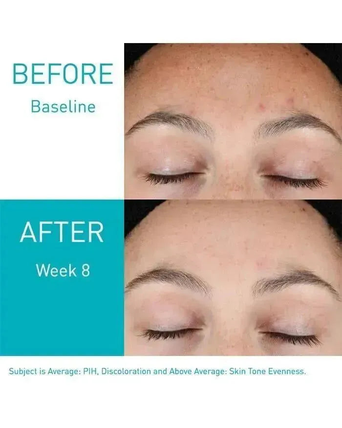 Anti-Aging Retinol Serum Cerave / High Pigmented